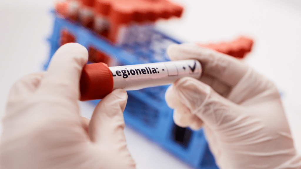 Légionellose et ballons d'eau chaude : le point de contrôle souvent oublié des propriétaires