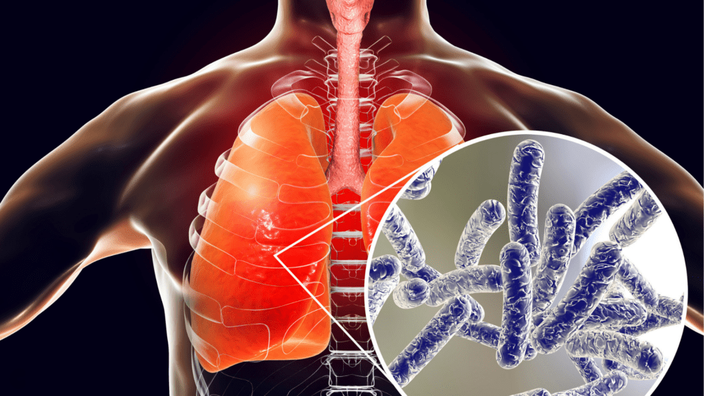 Légionellose et ballons d'eau chaude : le point de contrôle souvent oublié des propriétaires